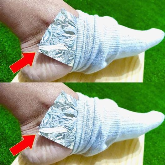 Put Aluminum Foil on Your Feet and Say Goodbye to Aches and Pains: The Surprising Hack