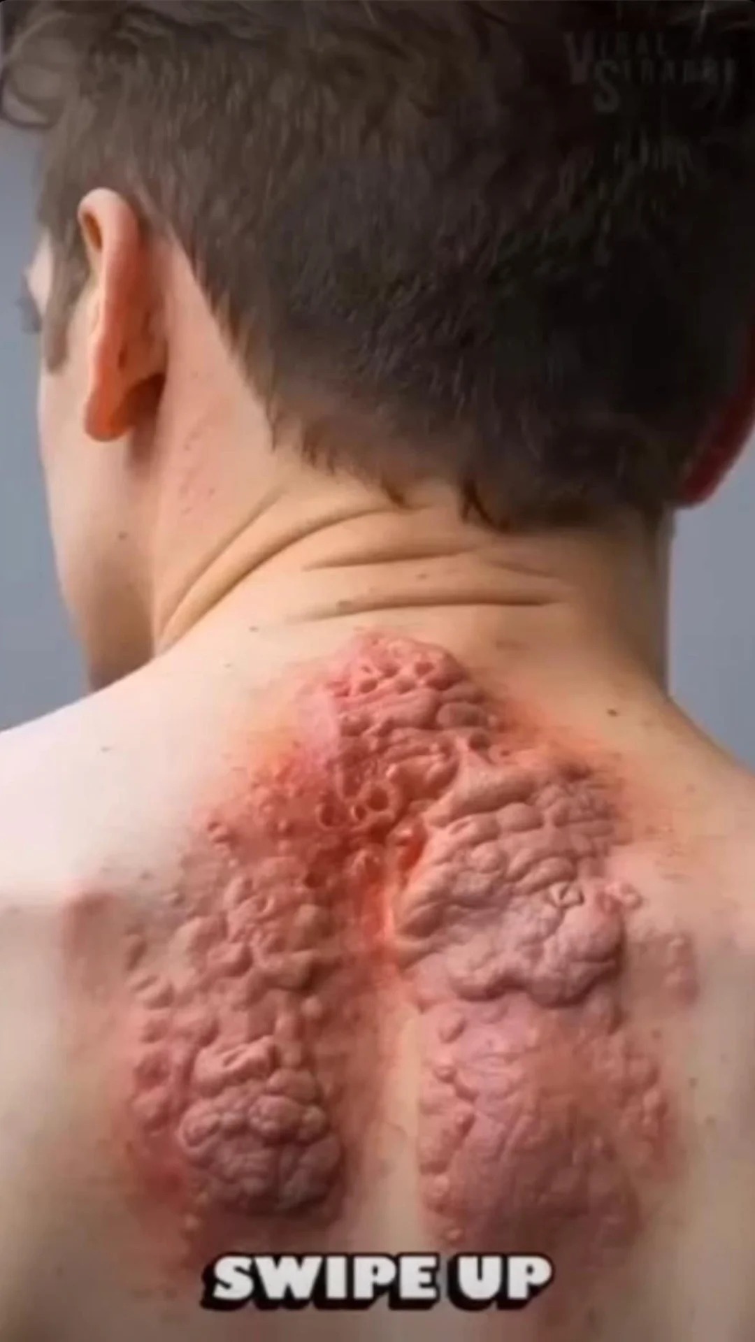 10 Symptoms That Your Body Is Not Right