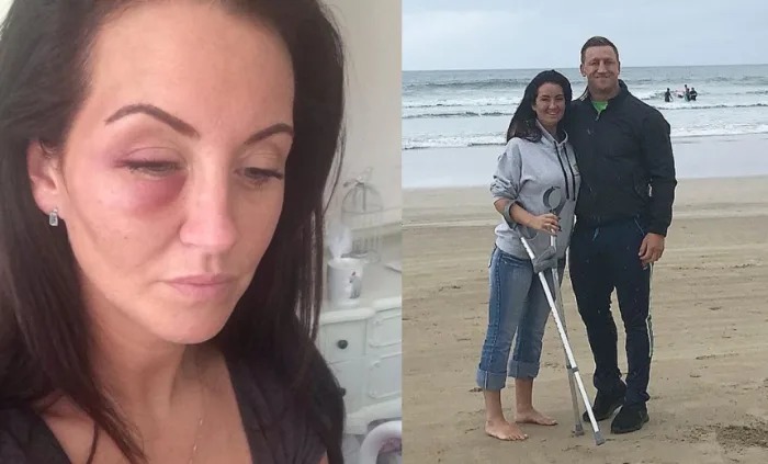 Husband Of 14 Years Walks Away From Wife After Hearing She’ll Never Walk Again, What Wife Did After Will Make You Tear Up