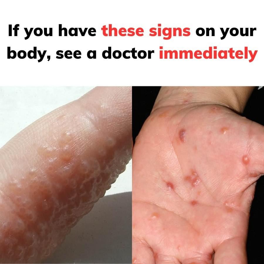 If you have these signs on your body, see a doctor immediately
