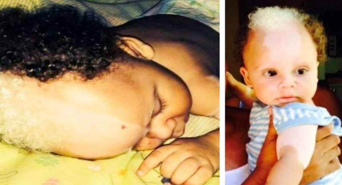 How does the child who was born seven years ago with an unusual look now appear?