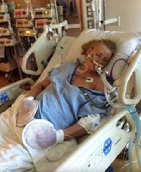 Her legs are amputated after using a common household product – Now she’s warning women everywhere