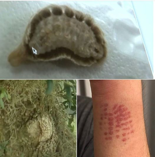 The Dangers Lurking In Your Backyard!