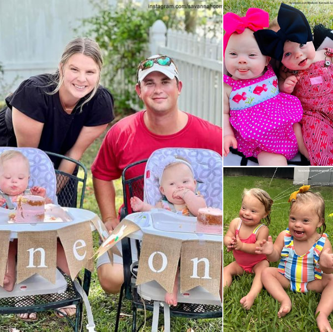 Mom of Extremely Rare Twins with Down Syndrome Shows How Beautiful They Are at 2 in Spite of Critics