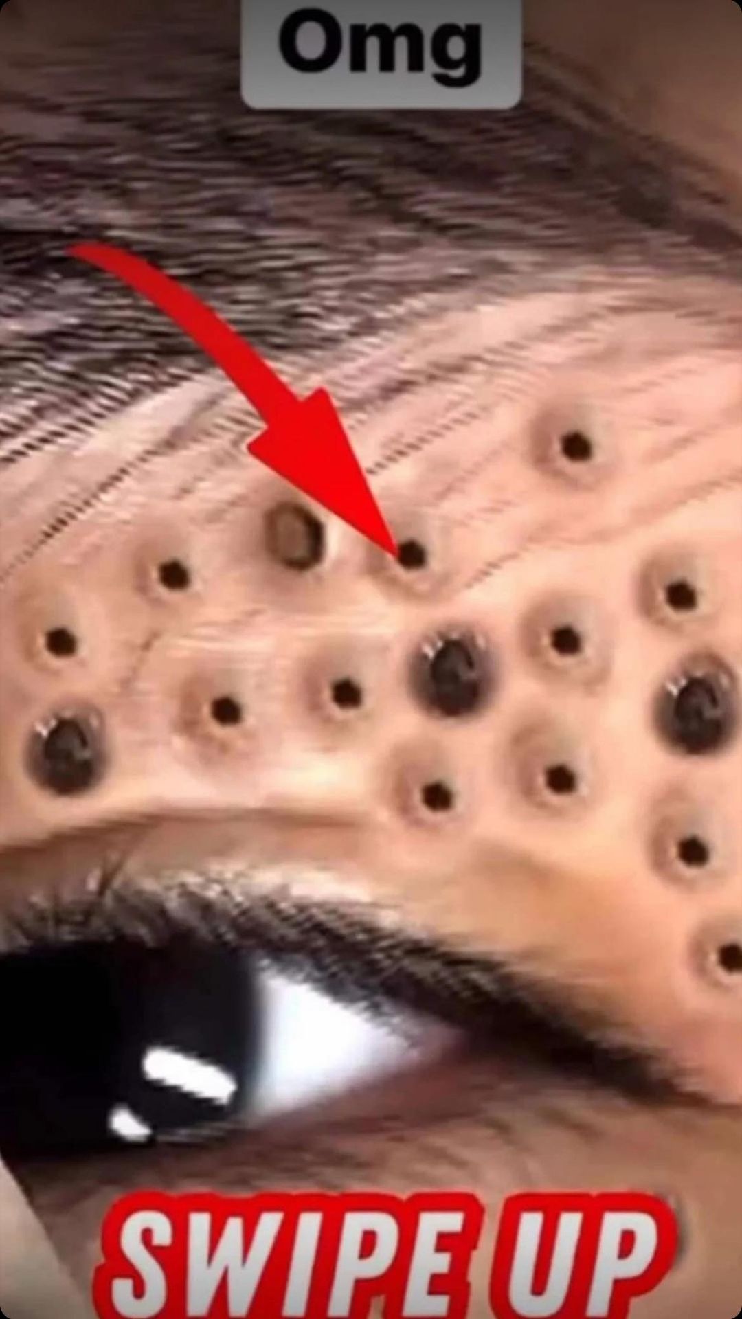 8 BODY Symptoms You Should Be Aware Of