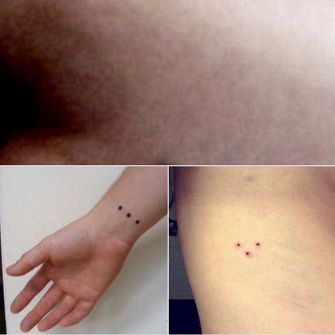 The ‘three-dot tattoo’ – potential meaning and significance