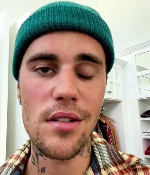 💔«It’s worrying that Justin Bieber is on the edge of a mental breakdown. »😰