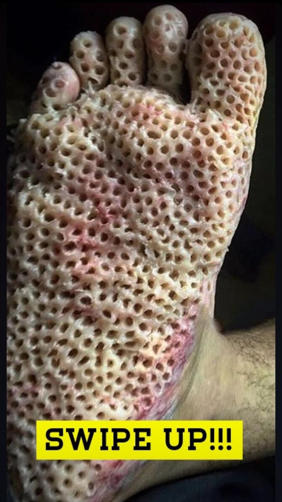 Serious diseases diagnosed via skin signals