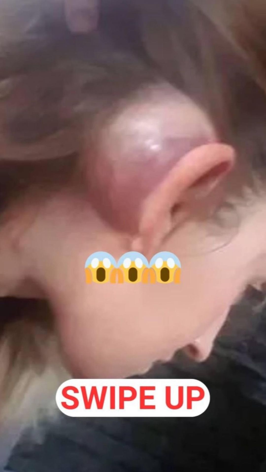 My monster Plenty of Fish date beat me so hard a TUMOUR formed behind my ear leaving me deaf