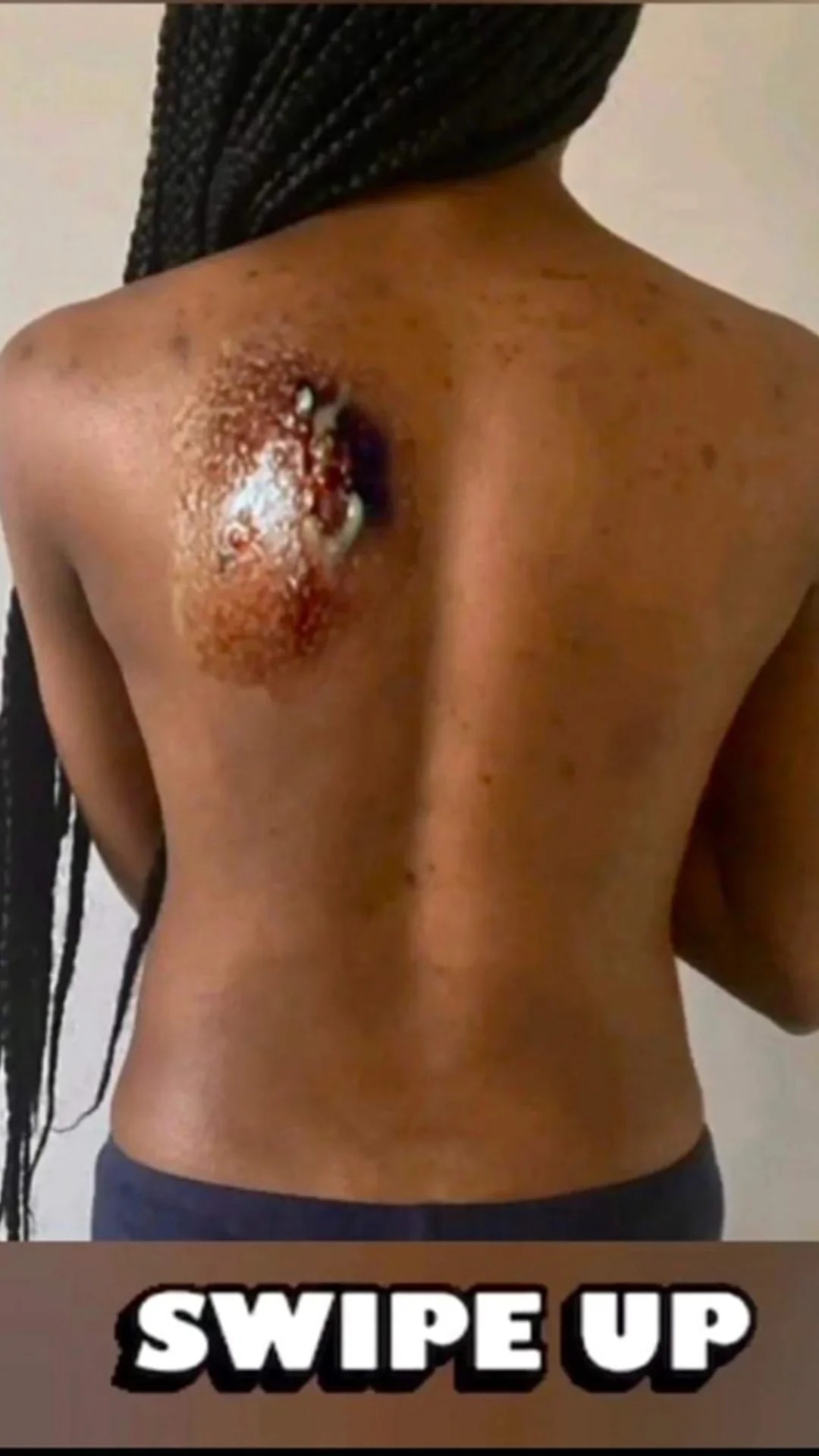 10 Signs That Something Is Wrong With Your Body