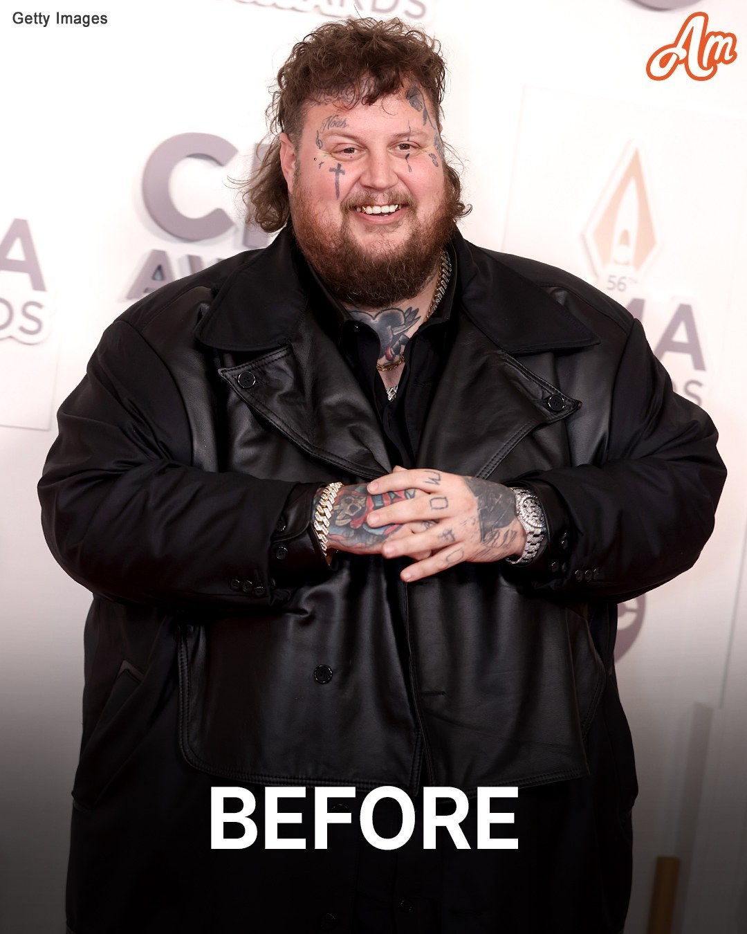 Country Singer Jelly Roll, 39, Wows Fans with 100-Lb Weight Loss: ‘Next Year When Y’all See Me, You Won’t Recognize Me’