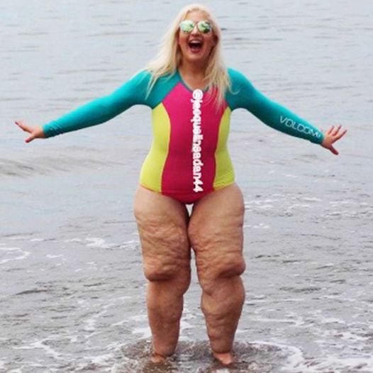 A woman who lost 350 pounds had the best response to being body shamed at the beach