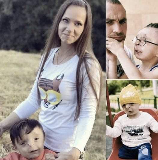 A couple adopts an undesirable ‘freak’ kid who was abandoned at birth, and you can see him now
