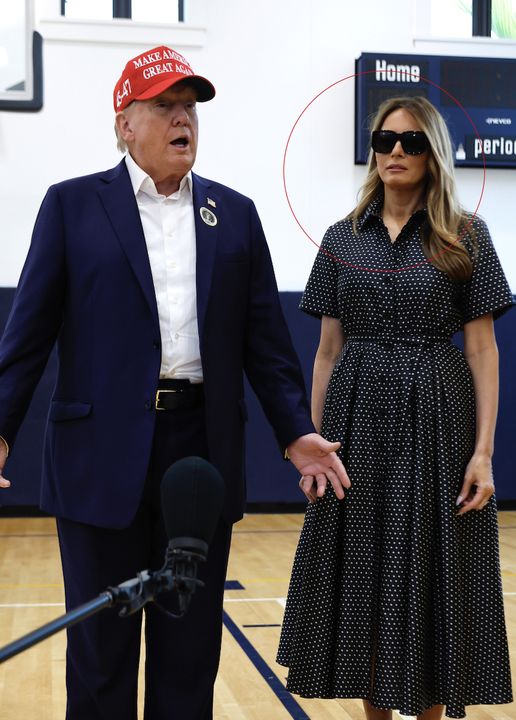 Melania Trump sparks plastic surgery rumors at Mar-a-Lago