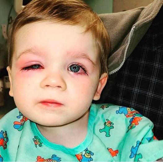 Mom issues warning after her child nearly lost his sight due to bath toy…