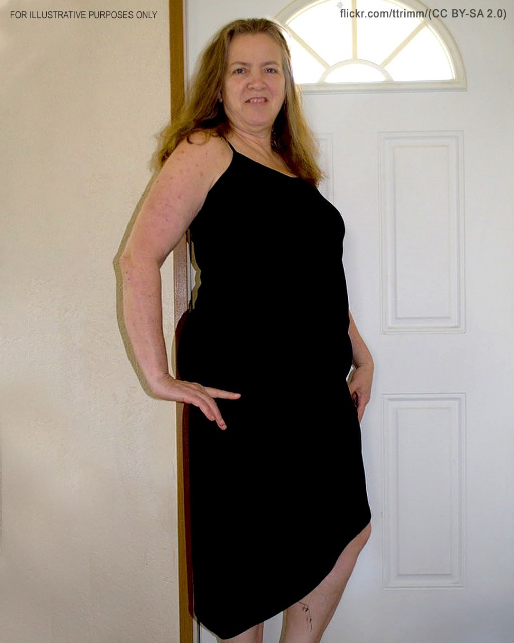 My MIL’s Dress on My Wedding Day Was the Last Straw for My Patience, So I Taught Her a Much-Deserved Lesson