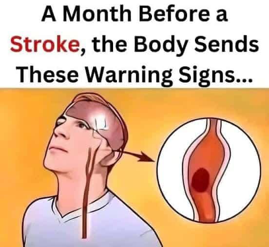 5 Stroke Symptoms That Can Be Lethal And Why You Need To Act ASAP