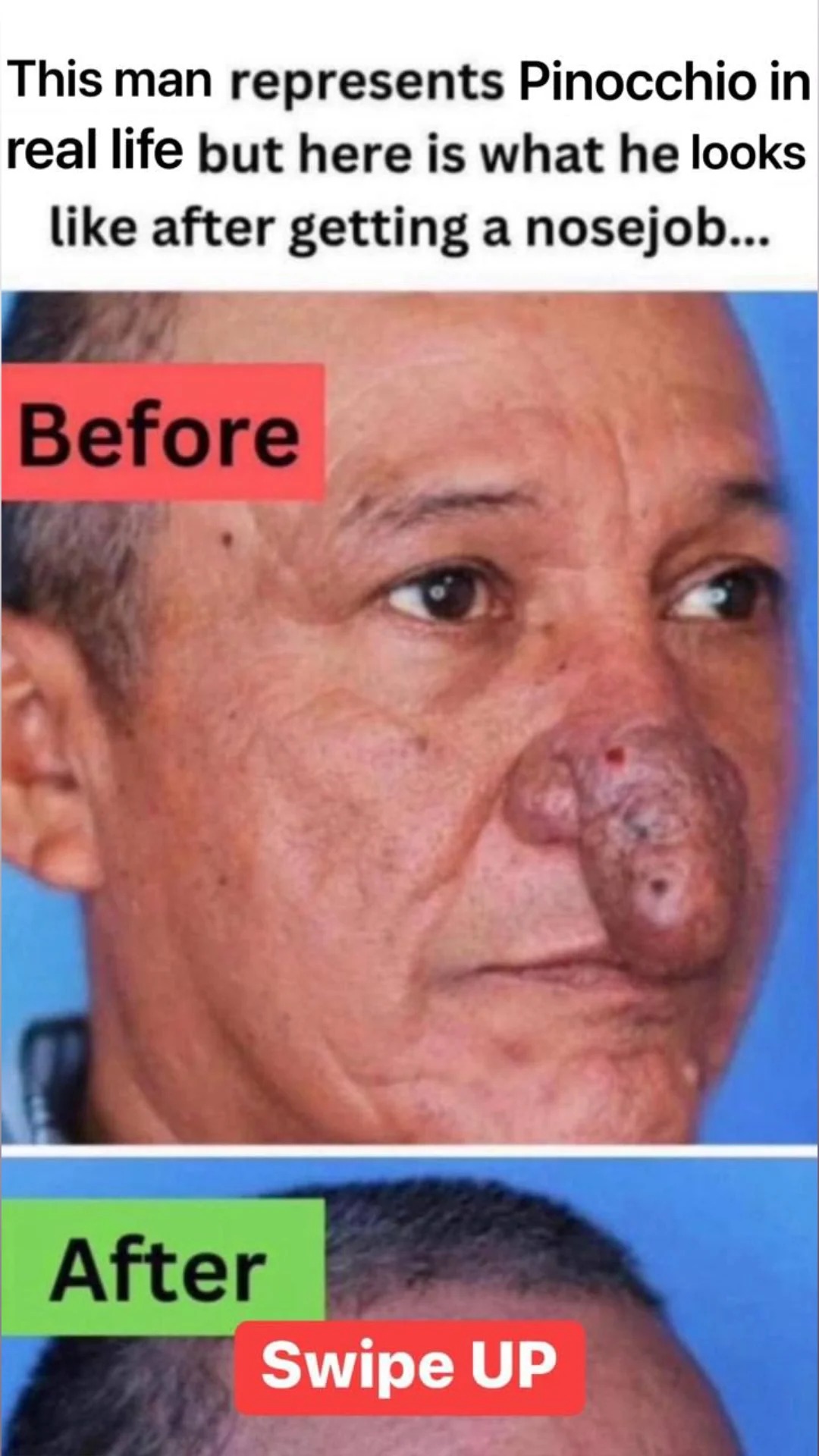 A Brush with Destiny: Conrado’s Remarkable Nose Transformation