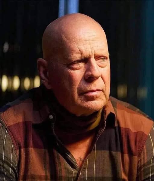 Bruce Willis Battles with Dementia