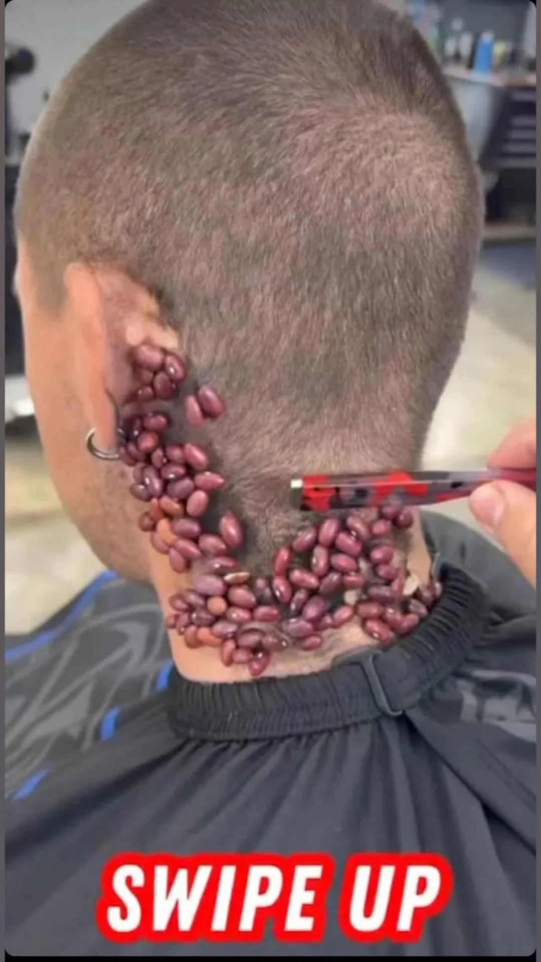 SEVEN THINGS THAT CLOG YOUR PORES AND CAUSE ACNE