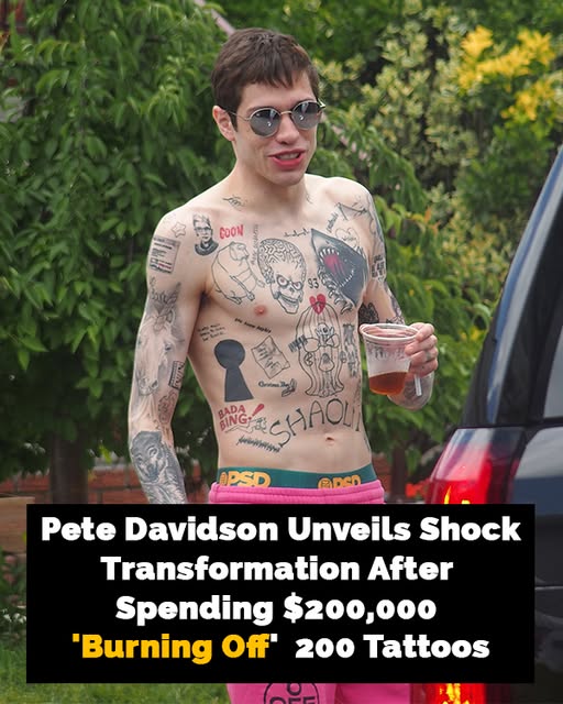 Pete Davidsonโs new look after โburning offโ almost 200 tattoos