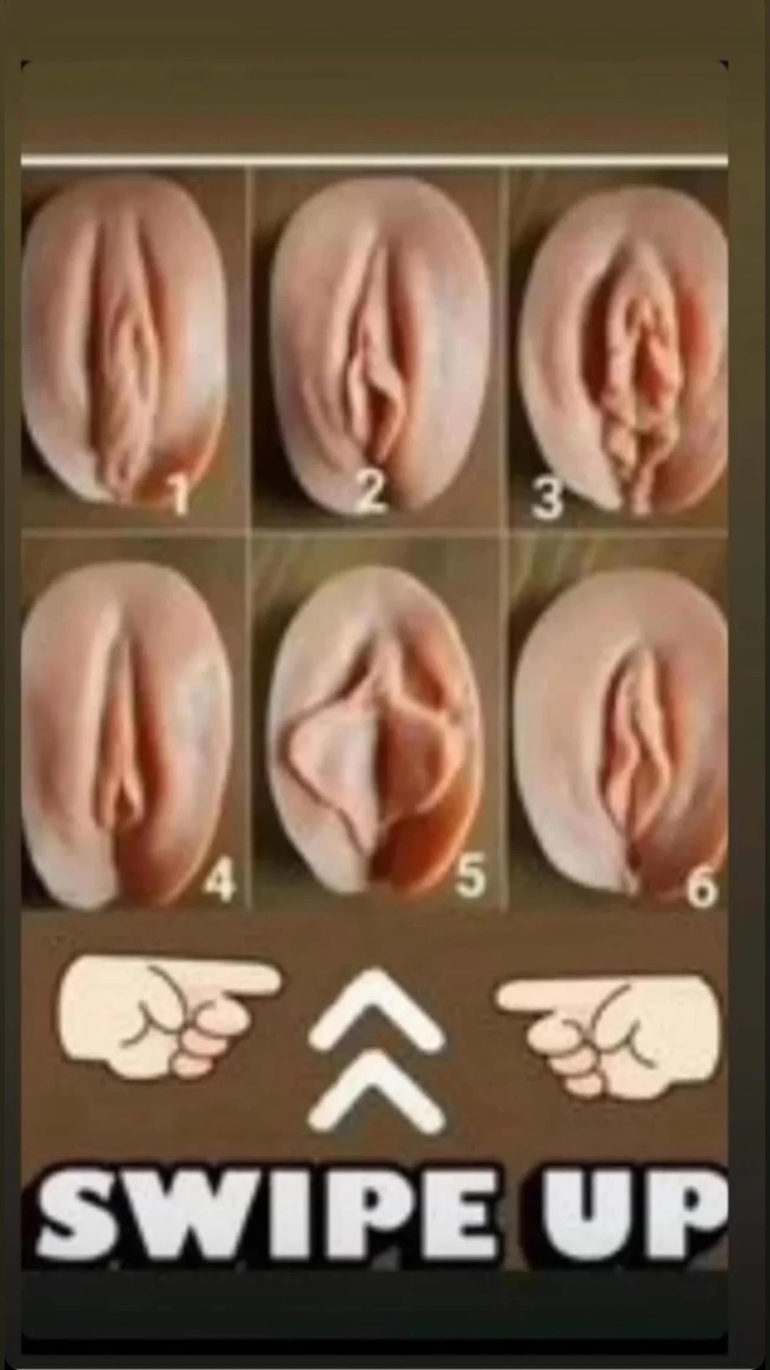 Types of vagina: Shapes, sizes, colors, and more