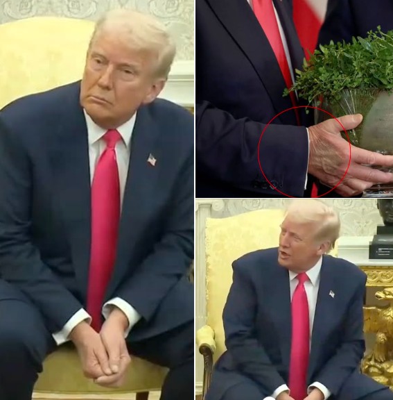 Health fears for Donald Trump grow after second mark spotted on his hand