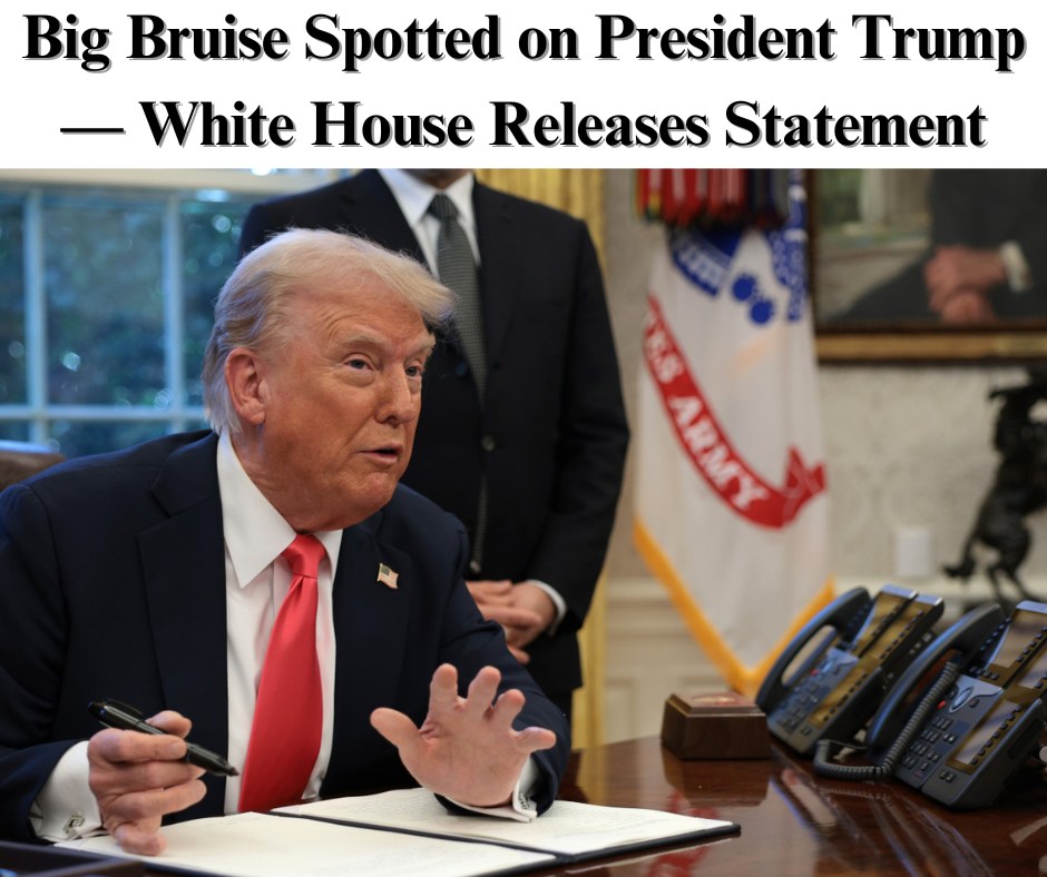 White House Releases Statement After Bruise Spotted On Trump