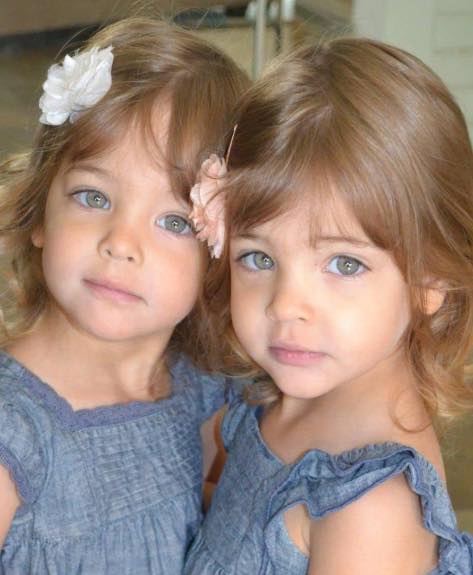 13 Years Ago They Were Called The World’s Most Beautiful Twins – Now Look At Them