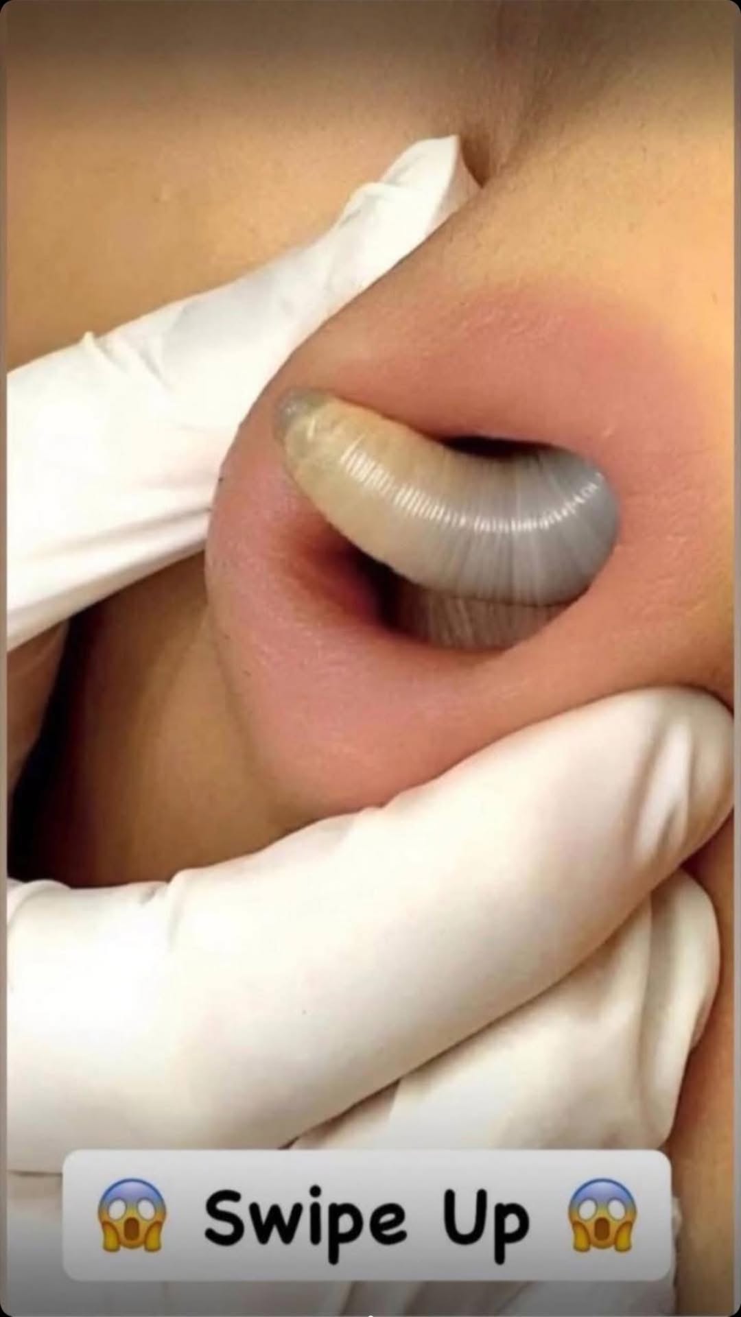 6 Symptoms of Ear Infection You Shouldn’t Ignore and Common Causes