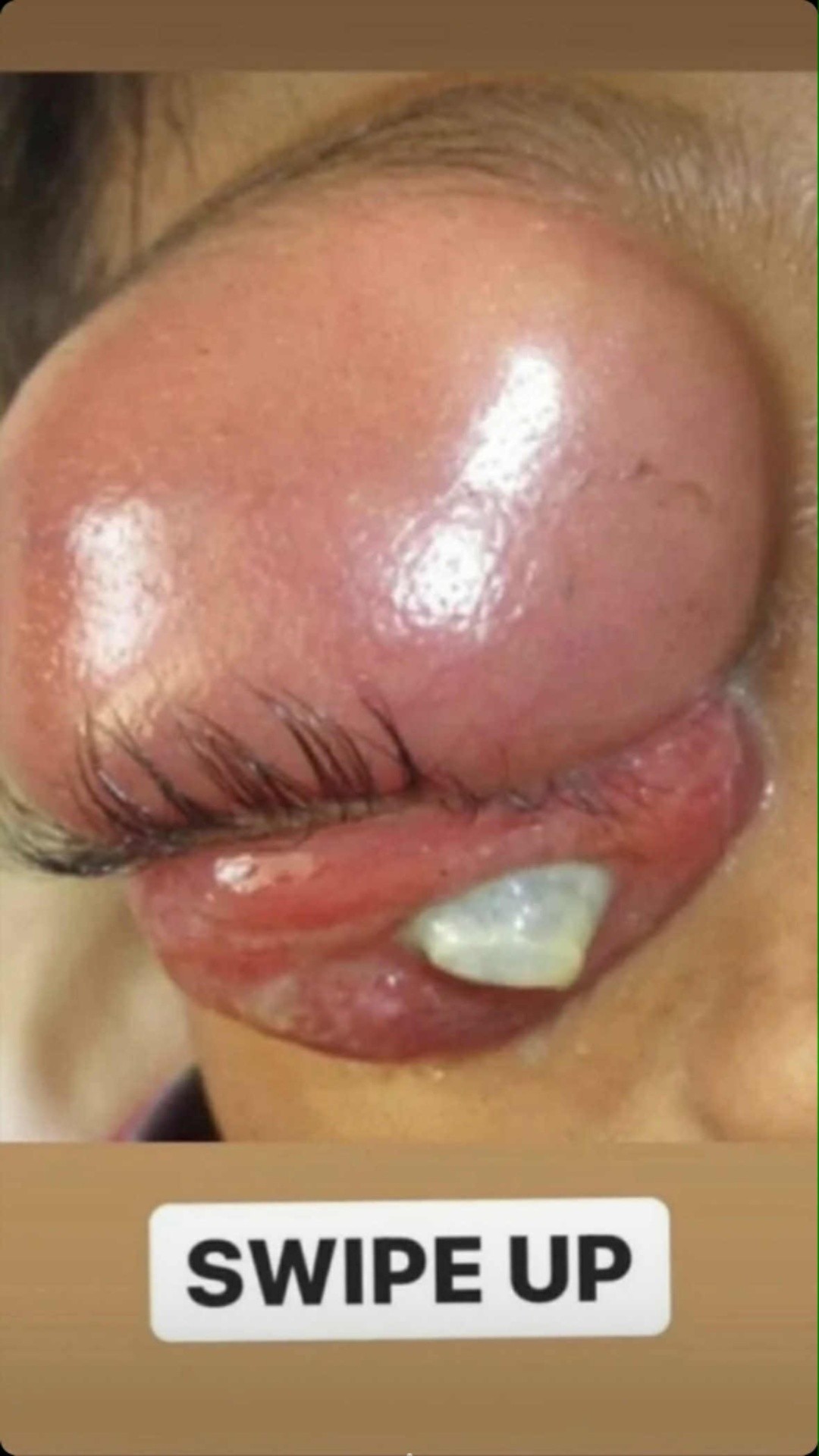 Important: Crucial Techniques for Preventing Infections in Your Eyes