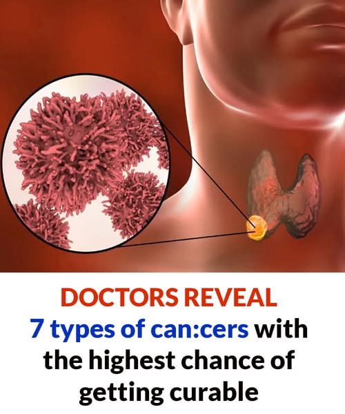 7 types of can:cers with the highest chance of getting curable
