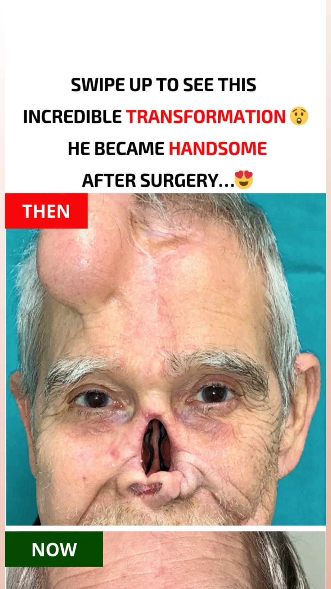 This transformation is really incredible… This man became handsome after surgery…