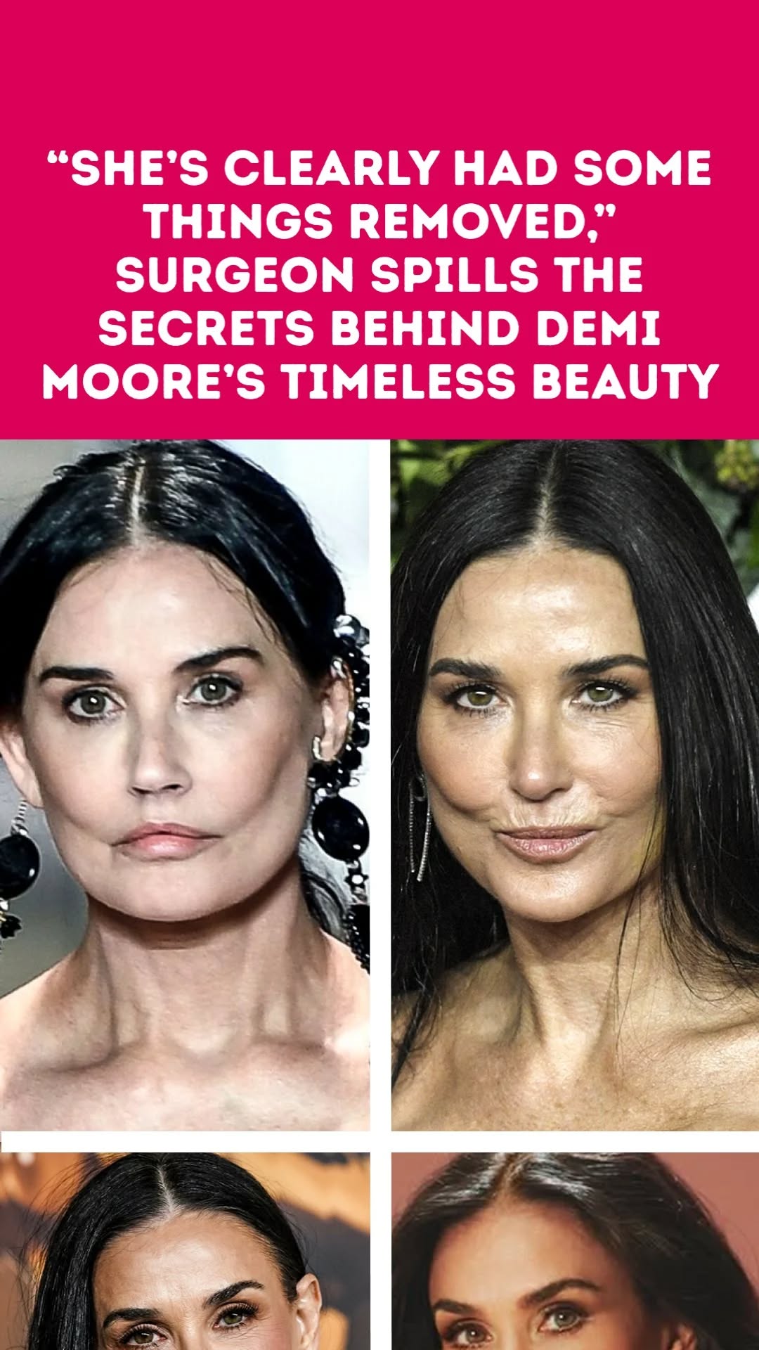 “She’s Clearly Had Some Things Removed,” Surgeon Spills the Secrets Behind Demi Moore’s Timeless Beauty