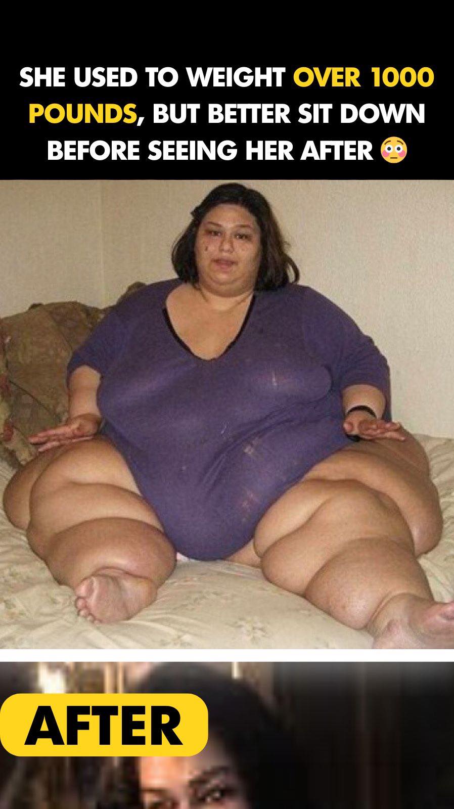 10 Of The Biggest Weight Loss Transformations Of All Time