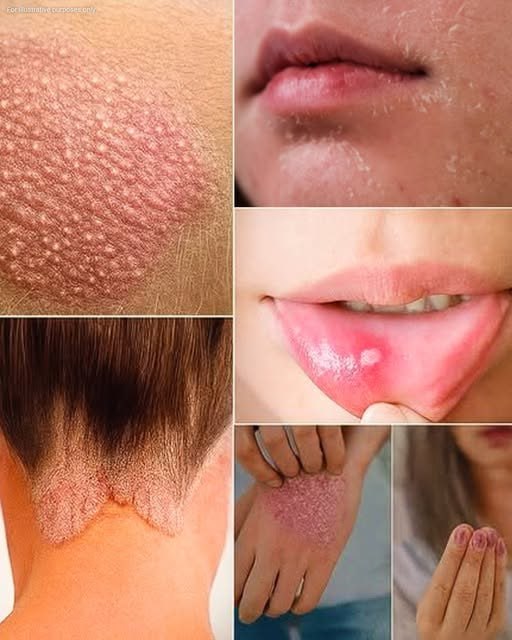 Signs you should know if you have this thing called…