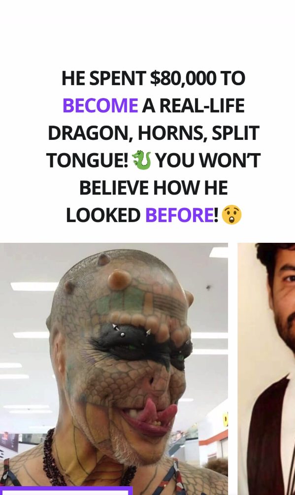He Spent $80,000 on Body Modifications to Become a Dragon – Here’s What He Looked Like Before