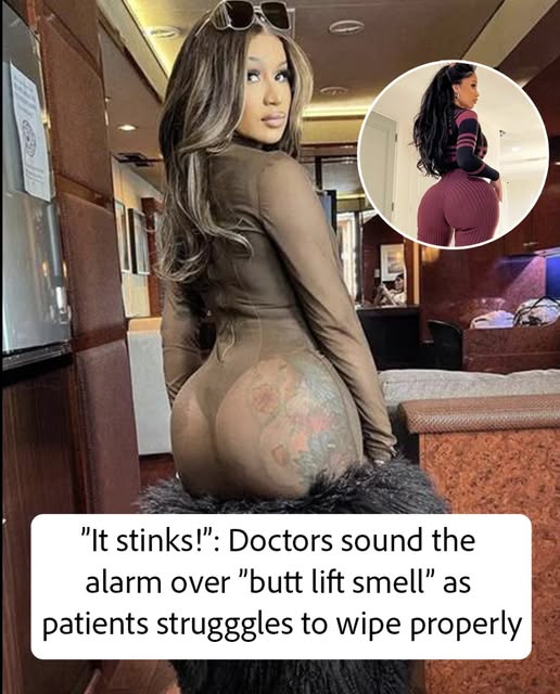 Doctors warn butt lift side effect may leave awful odor