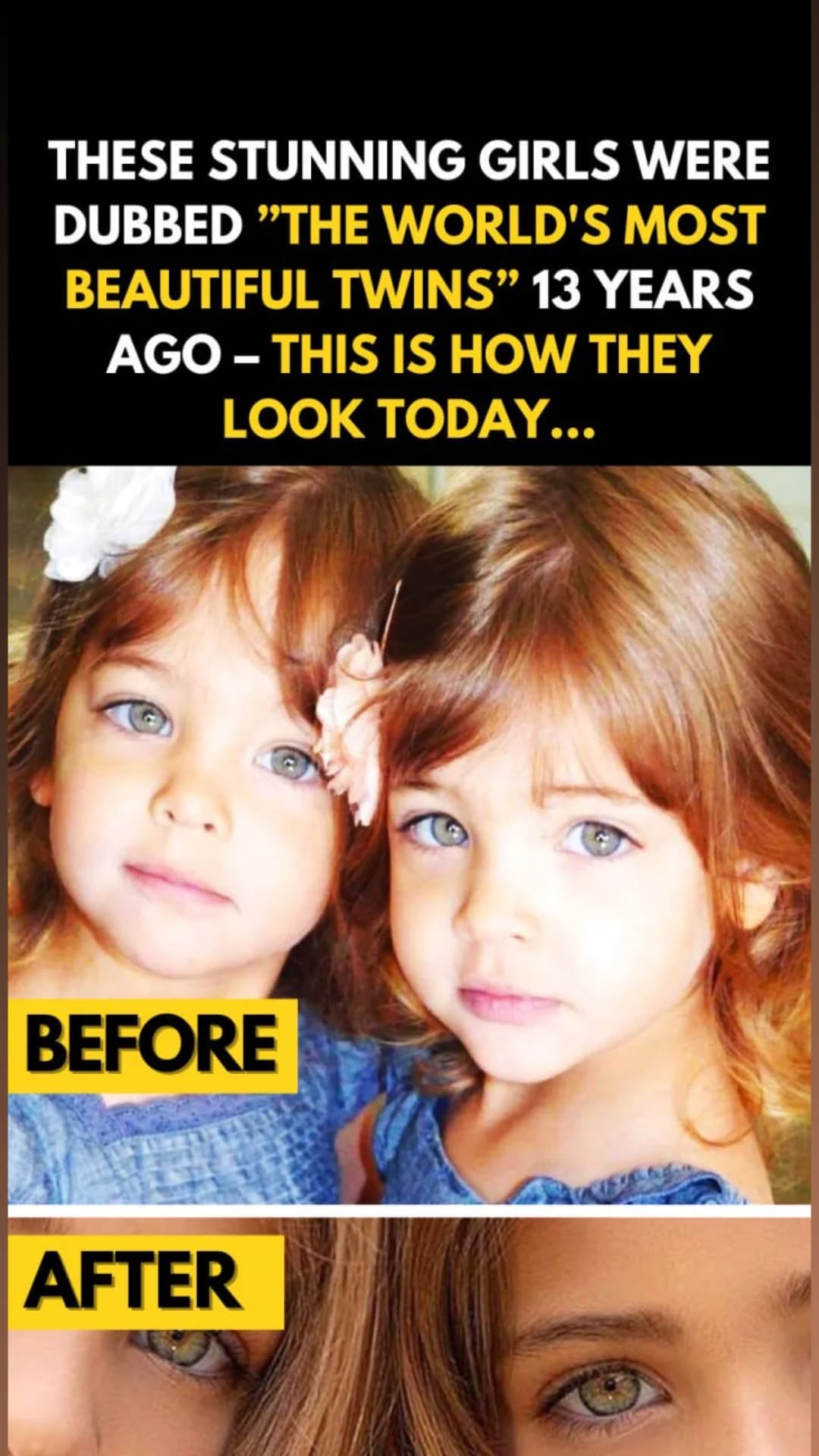 They Were Dubbed the “Most Beautiful Twins in the World” — What Happened Next Will Surprise You