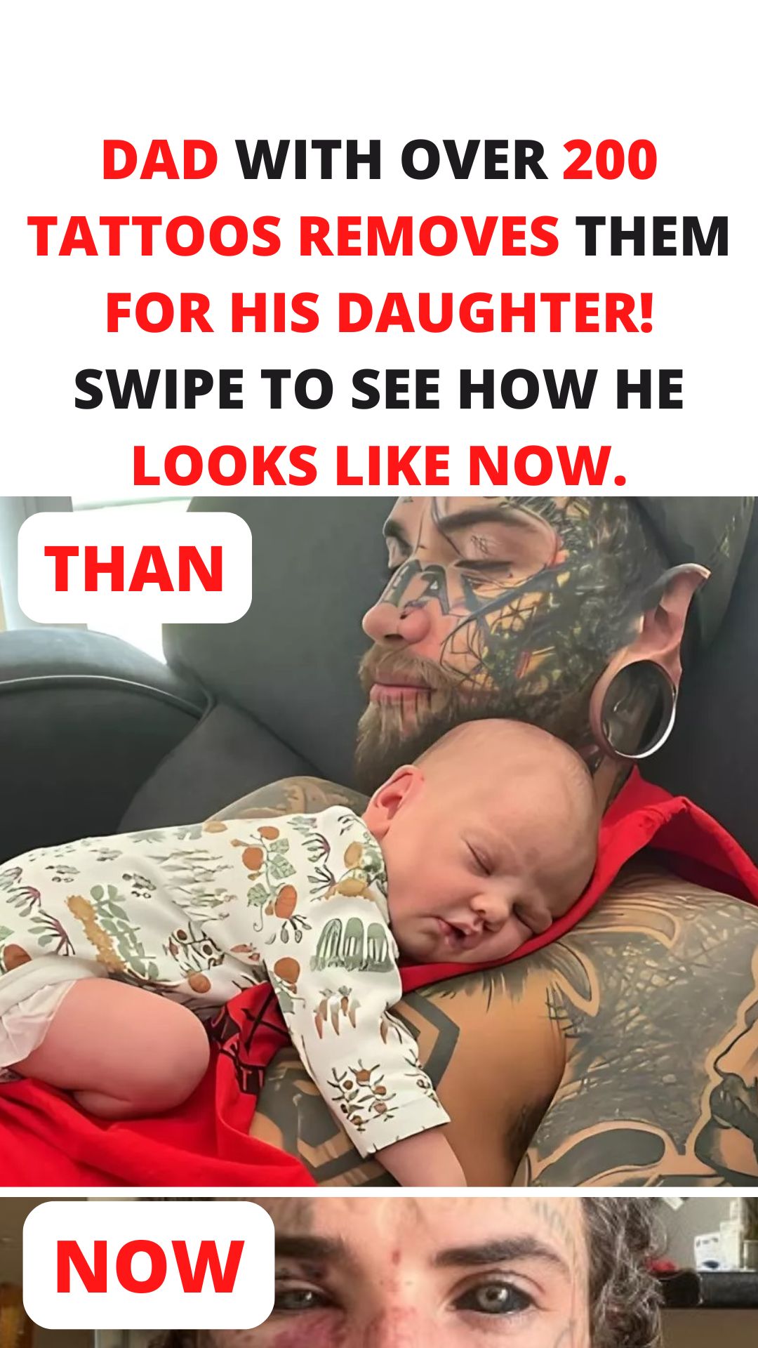 Dad Covered in Tattoos Undergoes Removal for His Daughter – See His Stunning Transformation!