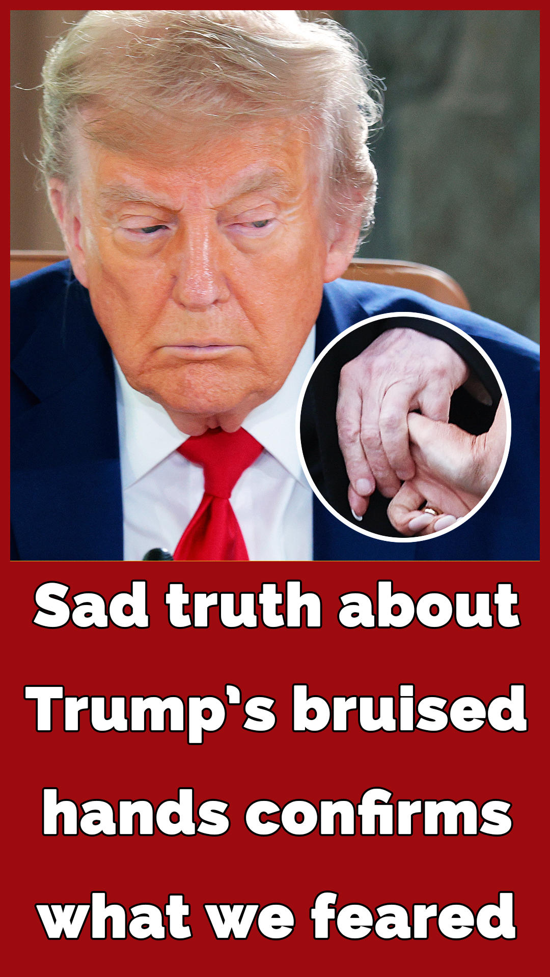 Health Fears Intensify as Trump Shows Off His ‘Wrinkled Hands’