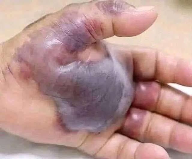 ATTENTION to these first signs of