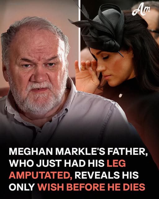 Meghan Markle’s Father Undergoes Partial Amputation