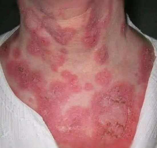 These are the consequences of s