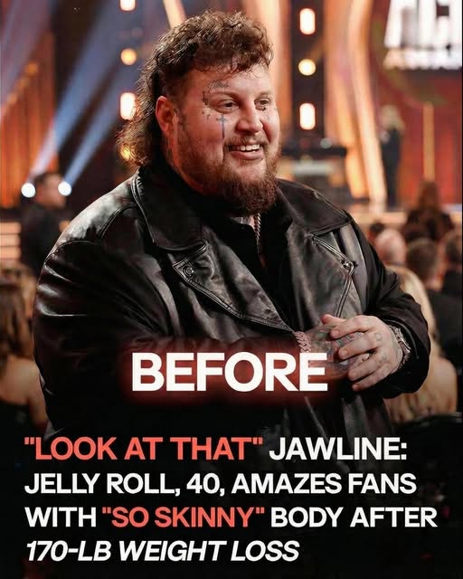 Jelly Roll Discusses Progress on His Long-Term Wellness Goals