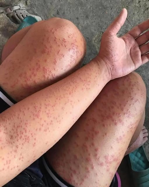 I spent a couple of nights at my friend’s previous apartment and saw these unusual bumps…