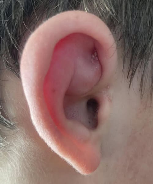 I noticed a strange patch of skin on my son’s ear this morning. His doctor appointment is still a week away — what should I do in the meantime?