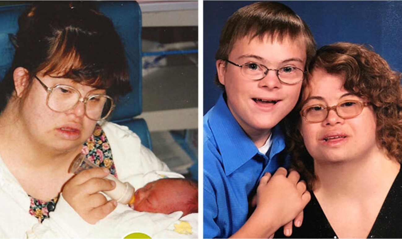 Couple Living with Down Syndrome Decide to Have Children, Draws Criticism