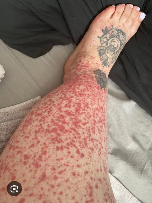 These are the consequences of sleeping with…