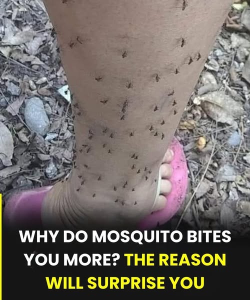 Why Mosquitoes Always Seem to
